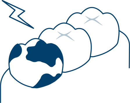 重度のむし歯で悩んでる