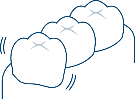 歯がグラグラする