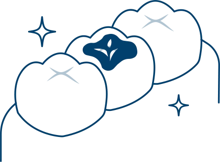 銀歯を白くしたい