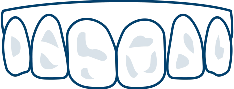 着色・汚れが気になる