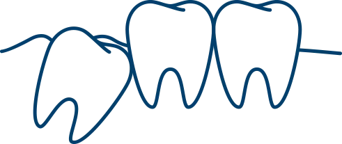 親知らずを抜きたい